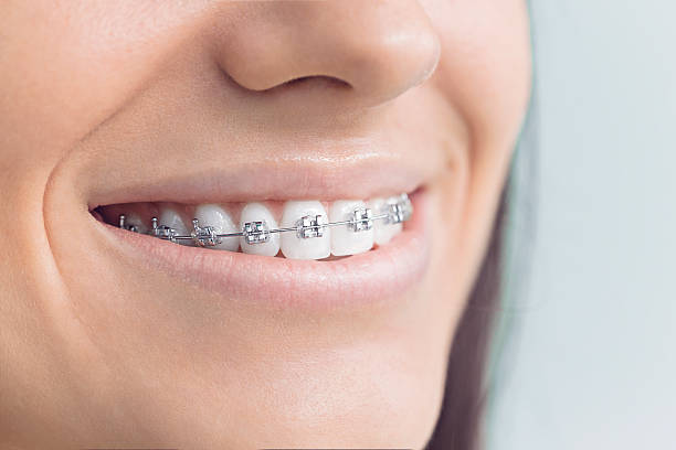 Best Dental Inlays and Onlays  in Hunters Creek, FL